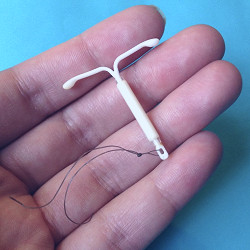 Intrauterine Device (IUD) | University Health Service